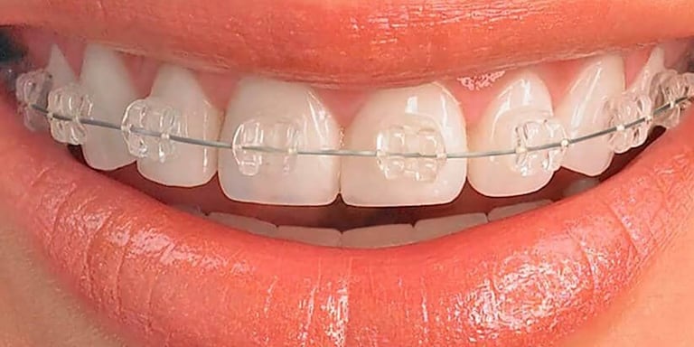 Odontoplace Ortodoncia en Cordón, Montevideo - Odontoplace